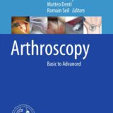 Arthroscopy Basic to Advanced