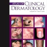 Atlas of Clinical Dermatology