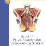 gynaecologic surgery