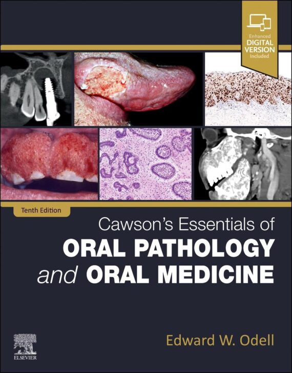 Cawson's Essentials of Oral Pathology and Oral Medicine 10th