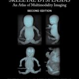 Fetal and Perinatal Skeletal Dysplasias An Atlas of Multimodality Imaging