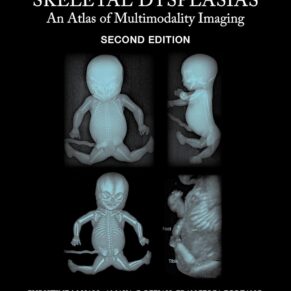 Fetal and Perinatal Skeletal Dysplasias An Atlas of Multimodality Imaging