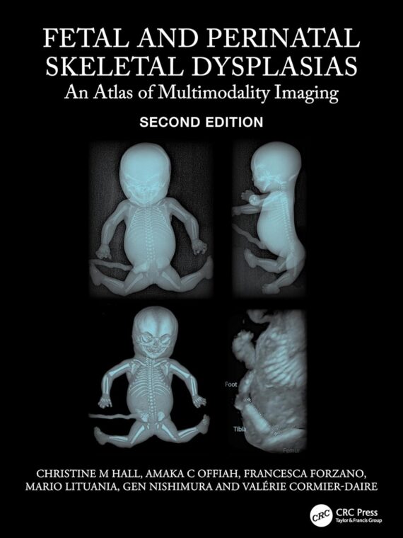 Fetal and Perinatal Skeletal Dysplasias An Atlas of Multimodality Imaging