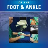 Ultrasound of the Foot and Ankle 1st Edition