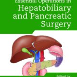 Bailey & Love's Essential Operations in Hepatobiliary and Pancreatic Surgery