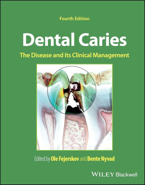 Dental Caries The Disease and its Clinical Management 4th Edition