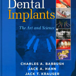 Dental Implants The Art and Science 2nd Edition