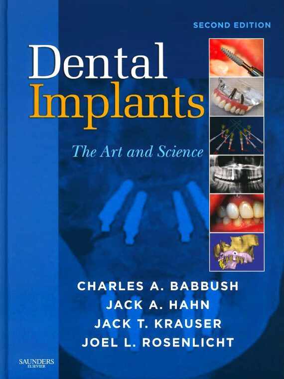 Dental Implants The Art and Science 2nd Edition
