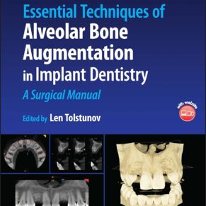 Essential Techniques of Alveolar Bone Augmentation in Implant Dentistry A Surgical Manual 2nd Edition