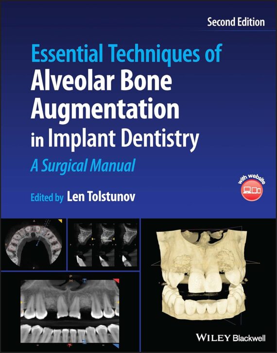 Essential Techniques of Alveolar Bone Augmentation in Implant Dentistry A Surgical Manual 2nd Edition