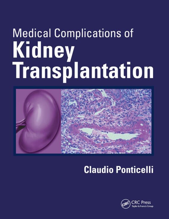 Kidney Transplantation