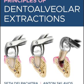 Principles of Dentoalveolar Extractions 1st Edition