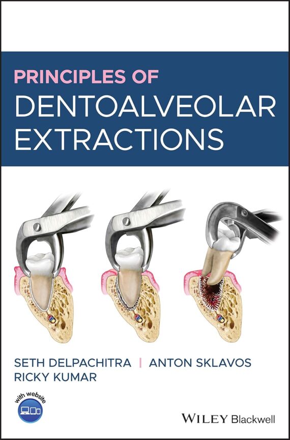Principles of Dentoalveolar Extractions 1st Edition