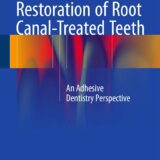 Restoration of Root Canal-Treated Teeth An Adhesive Dentistry Perspective