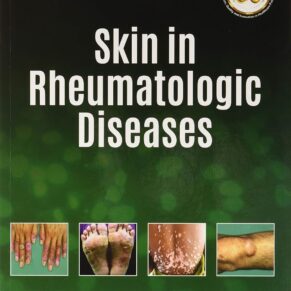 SKIN IN RHEUMATOLOGIC DISEASEs