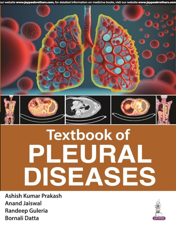 Textbook of Pleural Diseases by Ashish Kumar Prakash