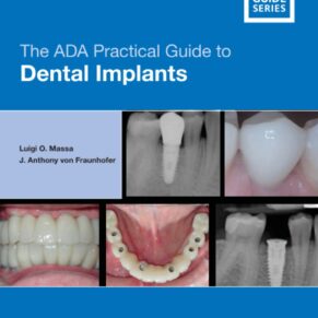 The ADA Practical Guide to Dental Implants 1st Edition by Luigi O. Massa (Author), J. Anthony von Fraunhofer (Author)