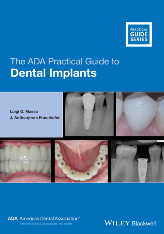 The ADA Practical Guide to Dental Implants 1st Edition by Luigi O. Massa (Author), J. Anthony von Fraunhofer (Author)