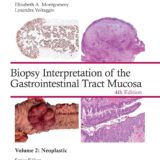 Biopsy Interpretation of the Gastrointestinal Tract Mucosa Volume 2- Neoplastic