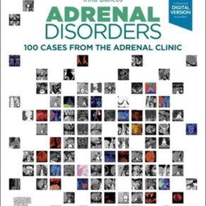 Adrenal Disorders 100 Cases from the Adrenal Clinic